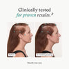 Before and after comparison of a person's face with text indicating clinical testing for results.